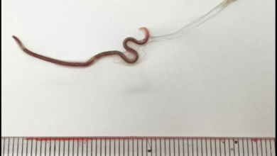Photo of Japonesa é diagnosticada com verme na garganta após comer sashimi