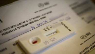 Photo of Casos confirmados da Covid-19 diminuíram quase 80% em Belém