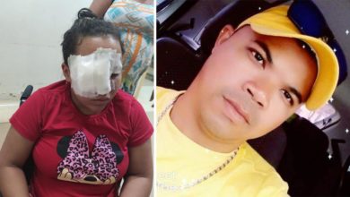 Photo of Mulher é espancada pelo próprio esposo após crise de ciúmes em Altamira