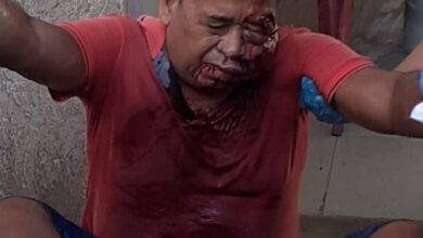 Photo of Tucuruí: Idoso é agredido a pauladas por morador de rua