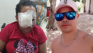 Photo of Cinegrafista da TV Record espanca esposa e foge para não ser preso. Vítima ficou com rosto desfigurado