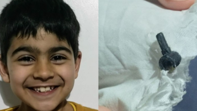 Photo of Após dois anos, peça de Lego sai do nariz de garoto de 7 anos