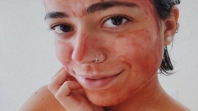 Photo of Influenciadora usa sangue da menstruação como máscara facial: ‘Pele de bebê’
