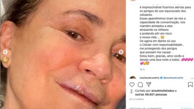 Photo of Regina Duarte sofre queda na rua e quebra três dentes: ‘Aterrissei de boca no chão’