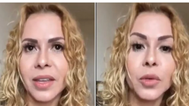 Photo of Joelma expõe que ficou com sequelas e revela inchaço : “Rosto dobrou”