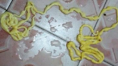 Photo of Homem retira verme de cinco metros de comprimento do próprio corpo