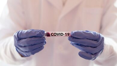 Photo of Estudo em hospital mostra que 80% dos pacientes internados com covid-19 tinham deficiência de vitamina D