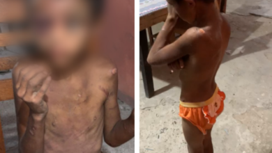 Photo of Criança de apenas nove anos é resgatada em estado deplorável de maus-tratos, em Maracanã