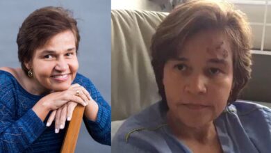 Photo of Claudia Rodrigues é internada às pressas em hospital de São Paulo