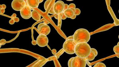 Photo of Candida auris: Brasil emite alerta sobre 1º caso de ‘superfungo’ fatal resistente a medicamentos