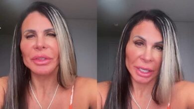 Photo of Após harmonização facial, Gretchen rebate críticas: “Povinho recalcado”