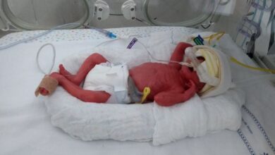 Photo of Amazonas pede ajuda para transferir 60 bebês prematuros