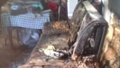 Photo of Idosa e bisneto têm 75% dos corpos queimados após criança queimar sofá