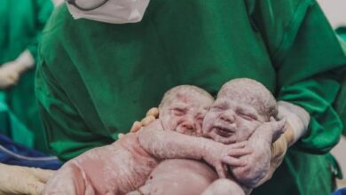 Photo of Gêmeas se abraçam após parto e fotos emocionam