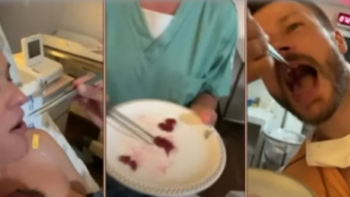 Photo of Fernanda Lima e Rodrigo Hilbert comeram placenta da filha após o parto