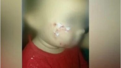 Photo of Paraense proíbe babá de socorrer criança atacada por cachorro para não perder a guarda