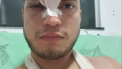 Photo of Jovem sofre trauma na cabeça e quebra  clavícula ao cair em buraco na Júlio Cézar, em Belém