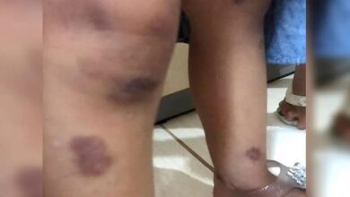 Photo of Casal paraense queimava bebê com bitucas de cigarro no DF