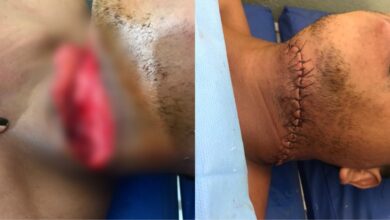 Photo of Homem tem pescoço cortado pela própria mulher em Itaituba