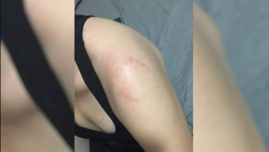 Photo of Mulher leva mordida de homem em quem esbarrou em academia