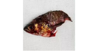 Photo of Homem quase morre depois que um peixe vivo entrou na boca dele