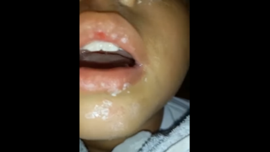 Photo of No Pará, criança de 2 anos ingere “super bonder” e é internada