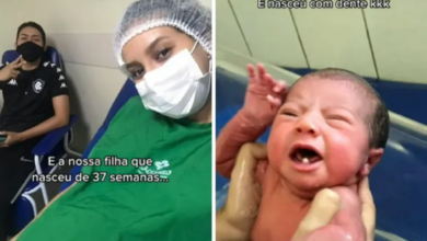 Photo of Bebê nasce com dois dentes em Ananindeua