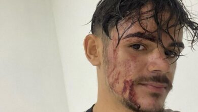 Photo of Motoboy denuncia agressão por atraso em entrega de açaí