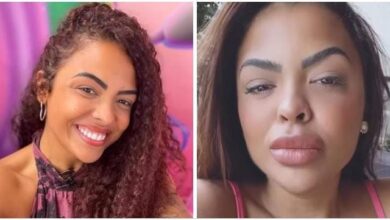 Photo of Paraense Paula investe em preenchimento labial e surge irreconhecível na web