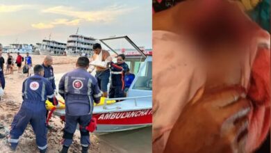 Photo of Homem é atacado por jacaré e tem braço lacerado, em Santarém