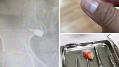 Photo of Herdeira do Grupo Liberal processa clínica odontológica por erro médico