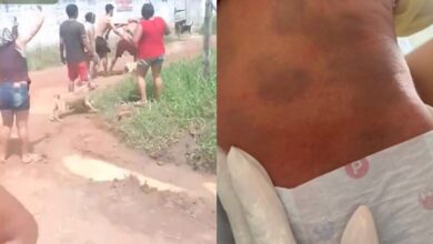 Photo of Exames apontam que marcas em bebê de Santo Antônio do Tauá não foram causadas por espancamento