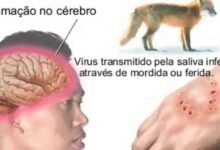Photo of Raiva humana: jovem do Pará morre no Amapá e caso alerta para riscos e protocolos de prevenção