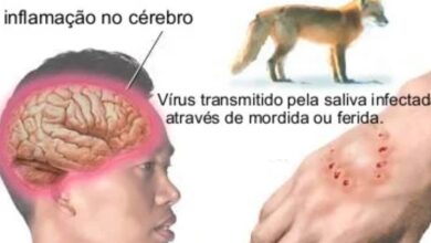 Photo of Raiva humana: jovem do Pará morre no Amapá e caso alerta para riscos e protocolos de prevenção