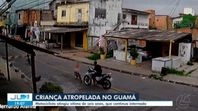 Photo of Criança de 6 anos perde o baço após ser atropelada por motociclista que fugiu em Belém
