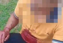 Photo of Dois indígenas Parakanã são baleados perto da Terra Indígena Apyterewa, no Pará