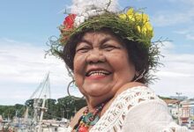 Photo of Dona Onete passa por cirurgia em Belém e apresenta boa recuperação, diz equipe