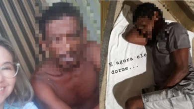 Photo of Vítima de agressão em Belém vive nas ruas há 15 anos e enfrenta transtornos mentais