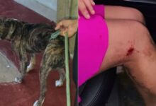 Photo of Mulher é atacada por pitbull no interior do Pará
