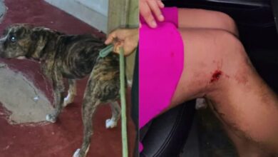 Photo of Mulher é atacada por pitbull no interior do Pará