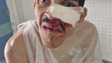 Photo of Pam Pam é transferido para Hospital Metropolitano e pode passar por cirurgia após atropelamento