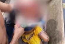 Photo of Criança sofre grave escalpelamento durante viagem de barco em Portel