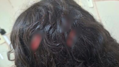 Photo of Adolescente de 13 anos é apreendido após atacar colega com faca em escola de Icoaraci
